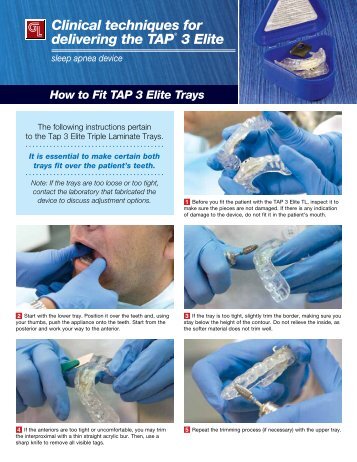 Clinical techniques for delivering the TAPÂ® 3 Elite - Glidewell Dental ...