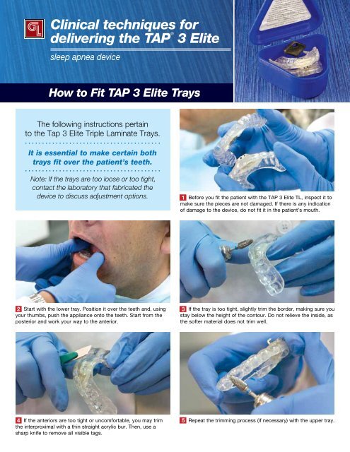 Clinical techniques for delivering the TAPÂ® 3 Elite - Glidewell Dental ...