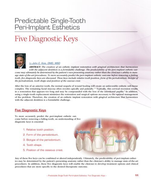 Five Diagnostic Keys Glidewell Dental Labs
