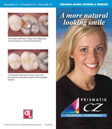 Prismatik CZ - Glidewell Dental Labs