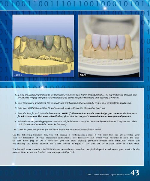 PDF Version - Glidewell Dental Labs