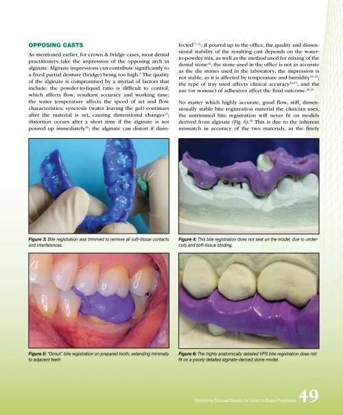 PDF Version - Glidewell Dental Labs
