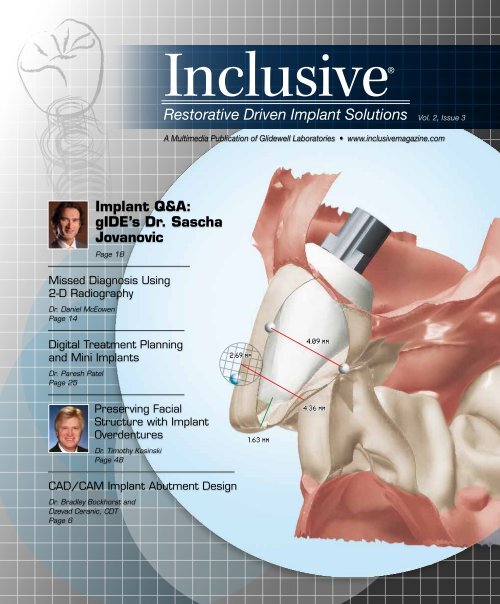 PDF Download Glidewell Dental Labs