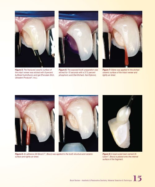 PDF Version - Glidewell Dental Labs