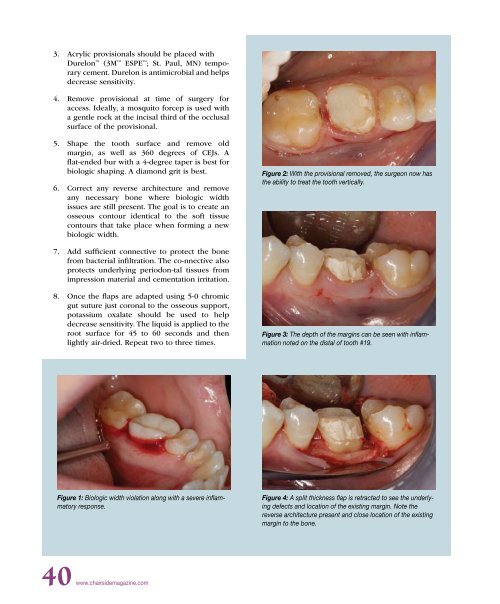 PDF Version - Glidewell Dental Labs