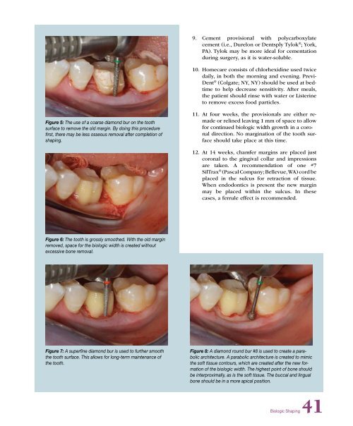 PDF Version - Glidewell Dental Labs