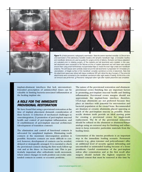 PDF Download - Glidewell Dental Labs