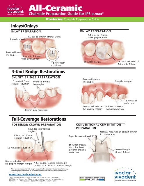 emax chairside prep guide - Glidewell Dental Labs