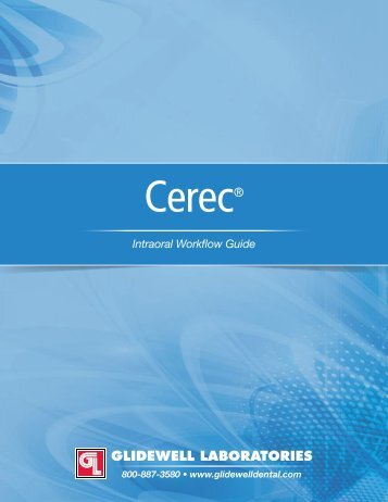 CEREC Intraoral Workflow Guide - Glidewell Dental Labs