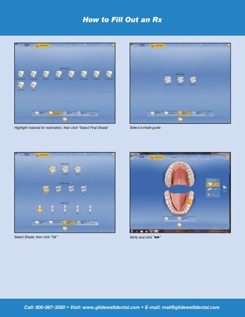 CEREC Intraoral Workflow Guide - Glidewell Dental Labs