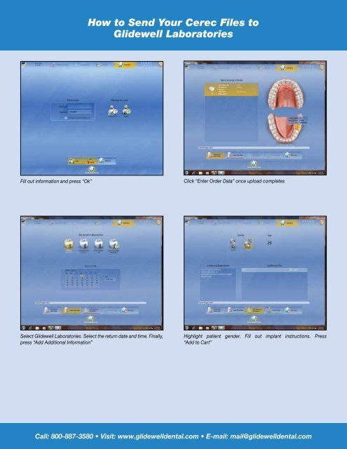 CEREC Intraoral Workflow Guide - Glidewell Dental Labs