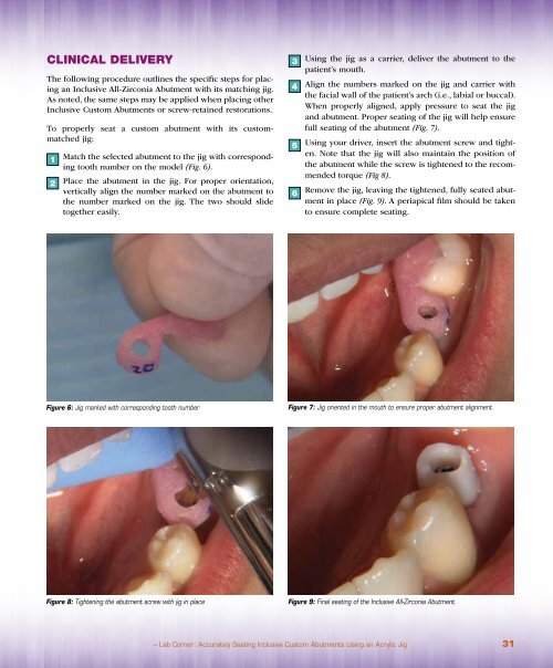 PDF Download - Glidewell Dental Labs