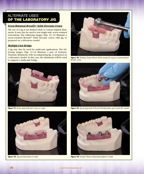 PDF Download - Glidewell Dental Labs