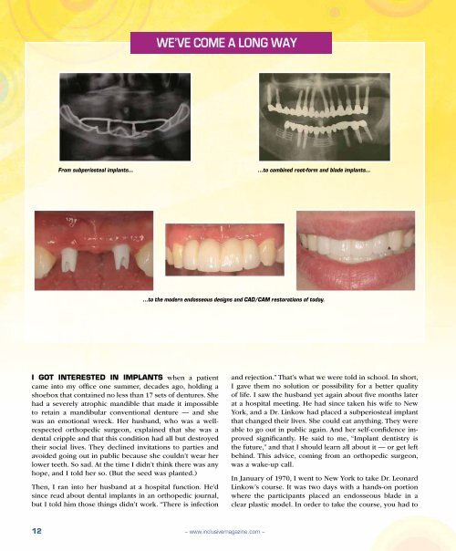 PDF Download - Glidewell Dental Labs