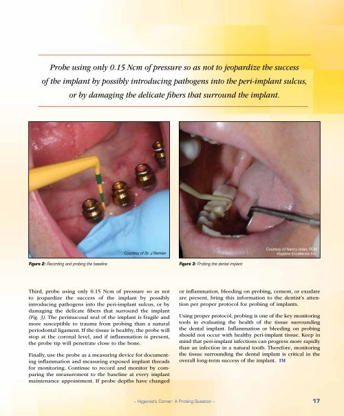 PDF Download - Glidewell Dental Labs