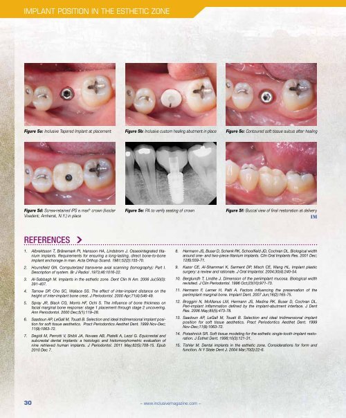 PDF Download - Glidewell Dental Labs