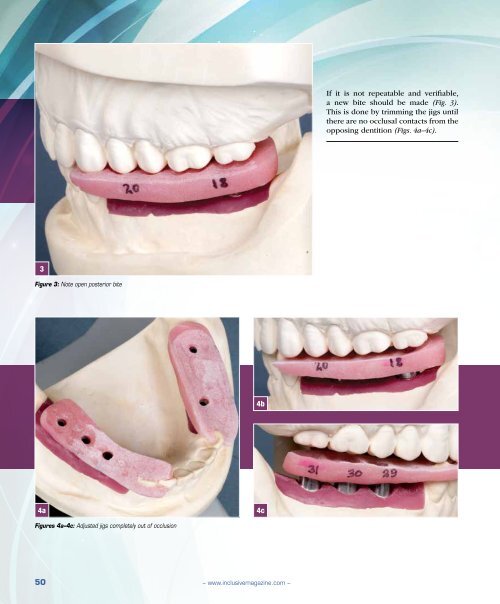 PDF Download - Glidewell Dental Labs