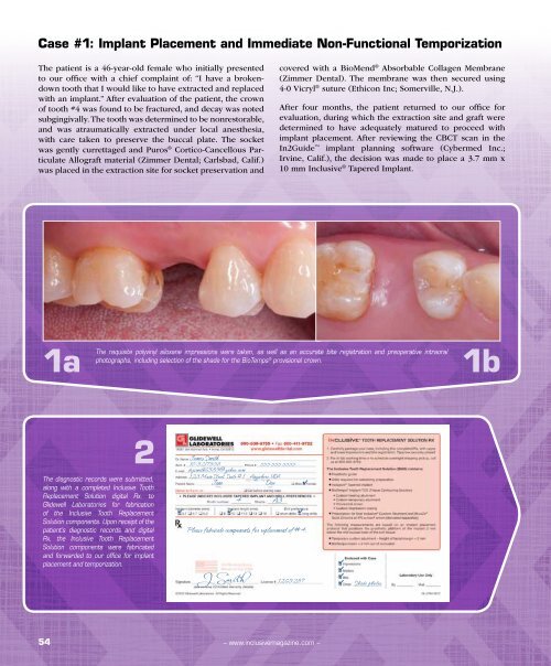 PDF Download - Glidewell Dental Labs