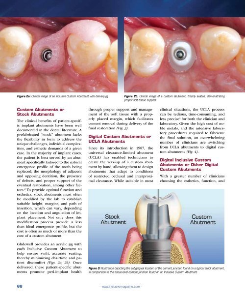 PDF Download - Glidewell Dental Labs