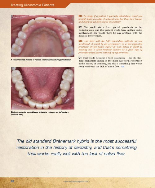 PDF Download - Glidewell Dental Labs