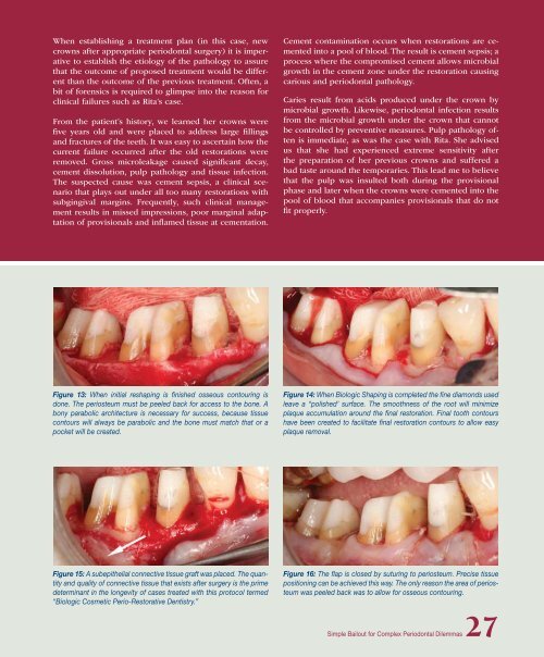 PDF Version - Glidewell Dental Labs