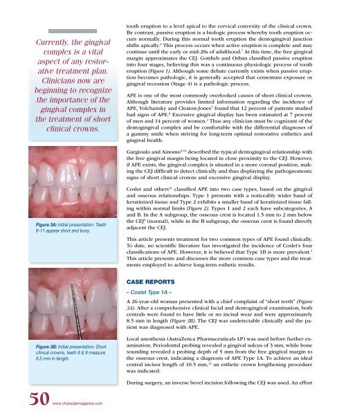 PDF Version - Glidewell Dental Labs