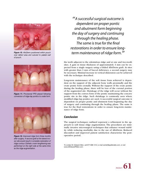 PDF Version - Glidewell Dental Labs