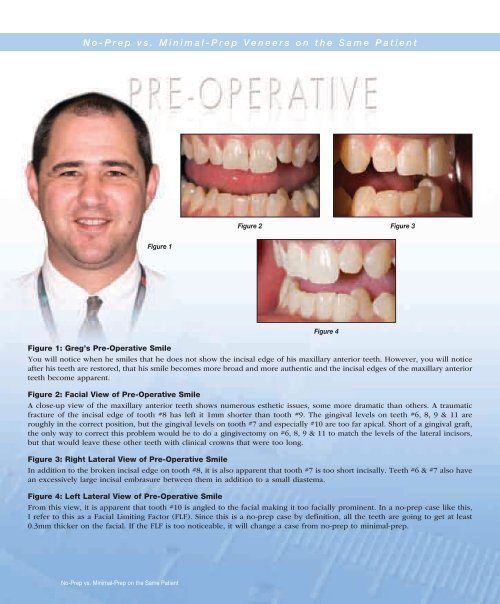 Chairside Magazine Volume 2, Issue 1 - Glidewell Dental Labs