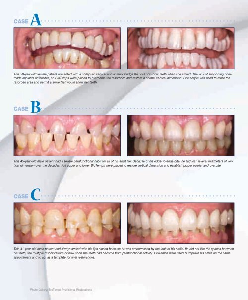 Chairside Magazine Volume 2, Issue 1 - Glidewell Dental Labs