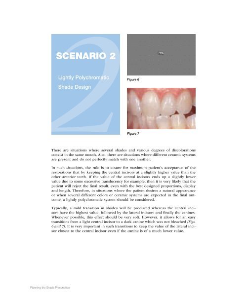 Chairside Magazine Volume 2, Issue 1 - Glidewell Dental Labs