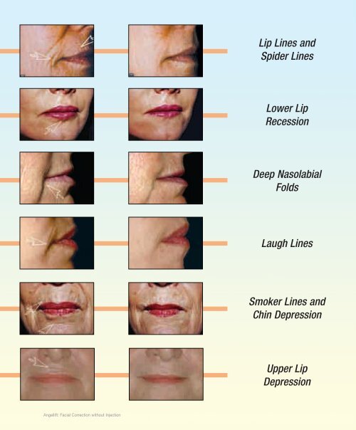 Chairside Magazine Volume 2, Issue 1 - Glidewell Dental Labs