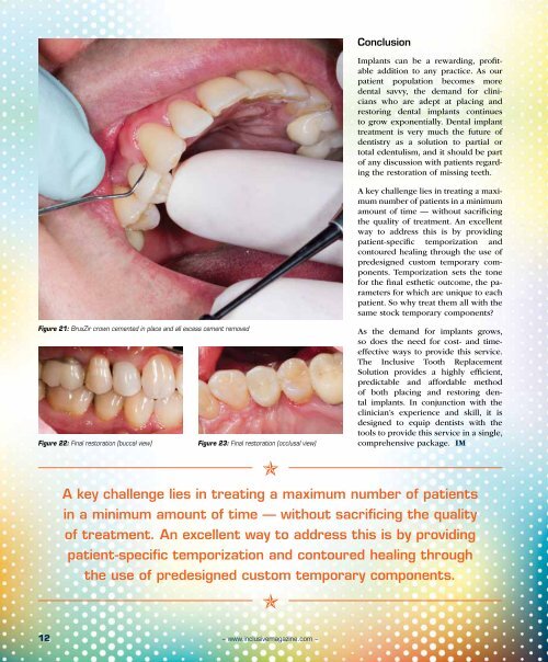 PDF Download - Glidewell Dental Labs