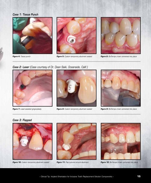 PDF Download - Glidewell Dental Labs