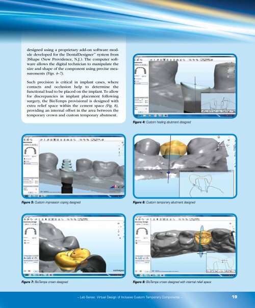 PDF Download - Glidewell Dental Labs