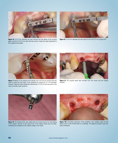 PDF Download - Glidewell Dental Labs