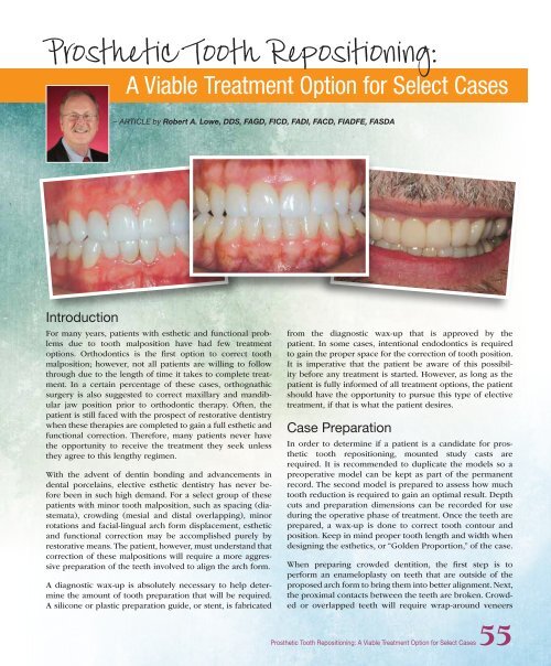 PDF Version - Glidewell Dental Labs