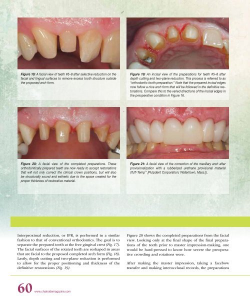 PDF Version - Glidewell Dental Labs