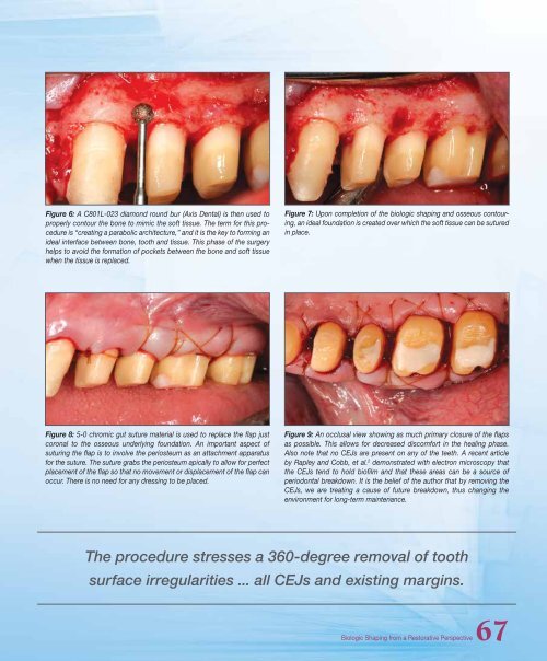 PDF Version - Glidewell Dental Labs