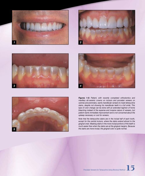 Chairside - Glidewell Dental Labs