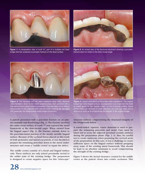 Chairside - Glidewell Dental Labs