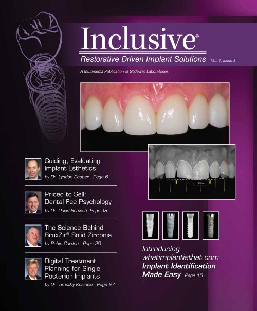 PDF Download Glidewell Dental Labs