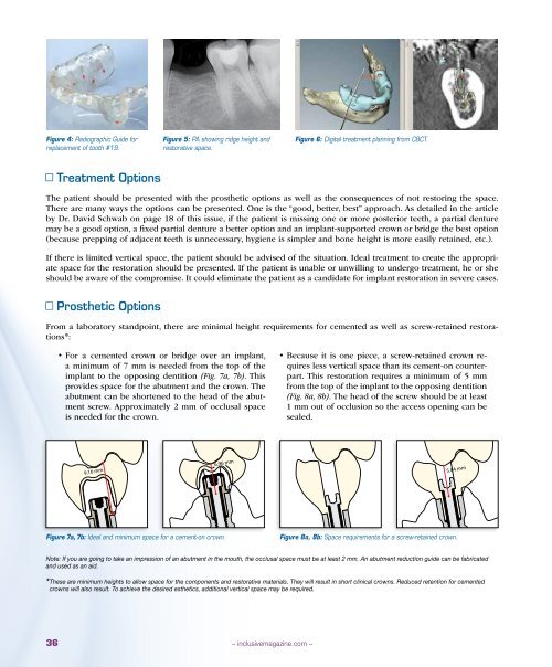 PDF Download - Glidewell Dental Labs