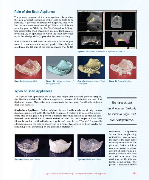 The Importance of the Scan Appliance - Glidewell Dental Labs