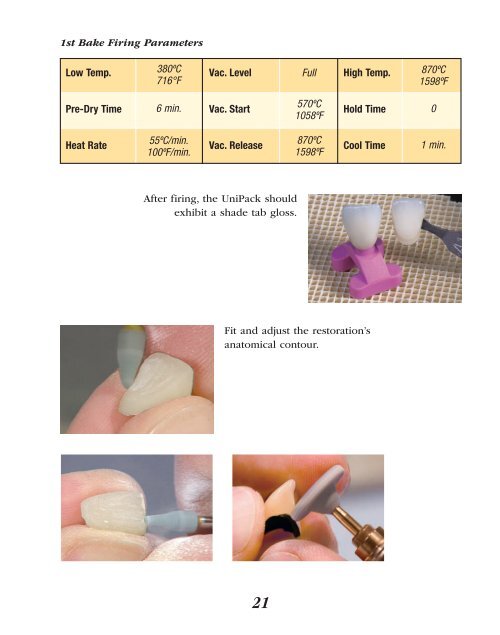 Prismatik UniPack Technique Manual - Glidewell Dental Labs