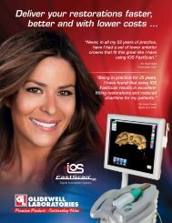 IOS FastScan - Glidewell Dental Labs