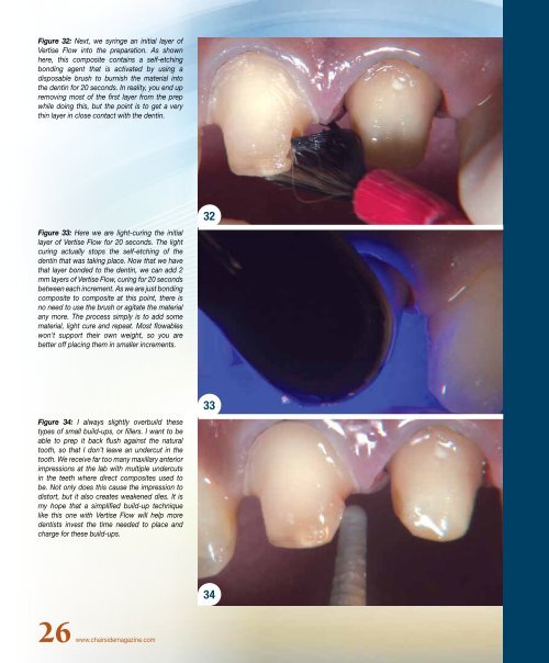 PDF Version - Glidewell Dental Labs