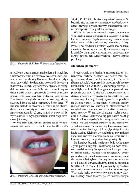 peÅna wersja do pobrania - Protetyka Stomatologiczna