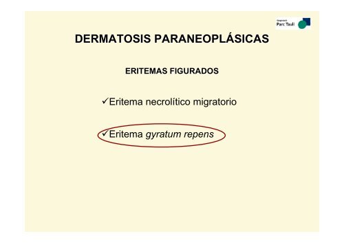 iv curs d'actualització en medicina dermatosis paraneoplásicas