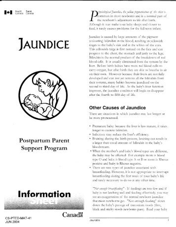 Jaundice