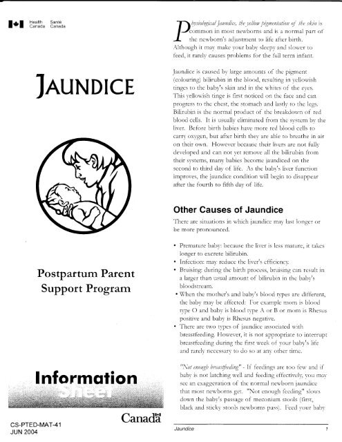 Jaundice